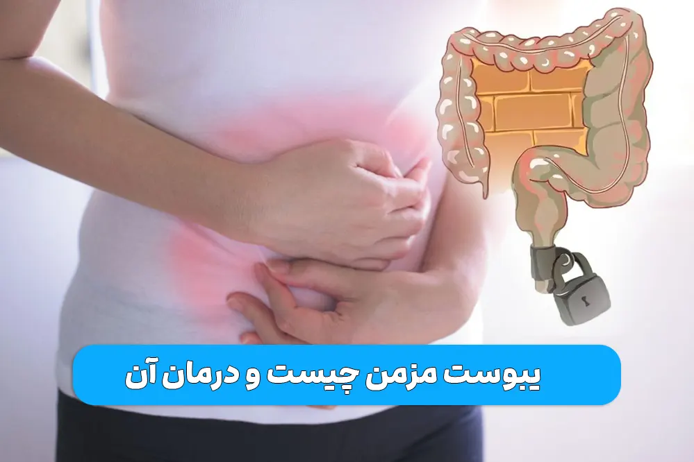 یبوست